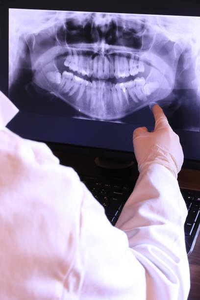 Best Emergency Root Canal Treatment in Golden Grove, SC